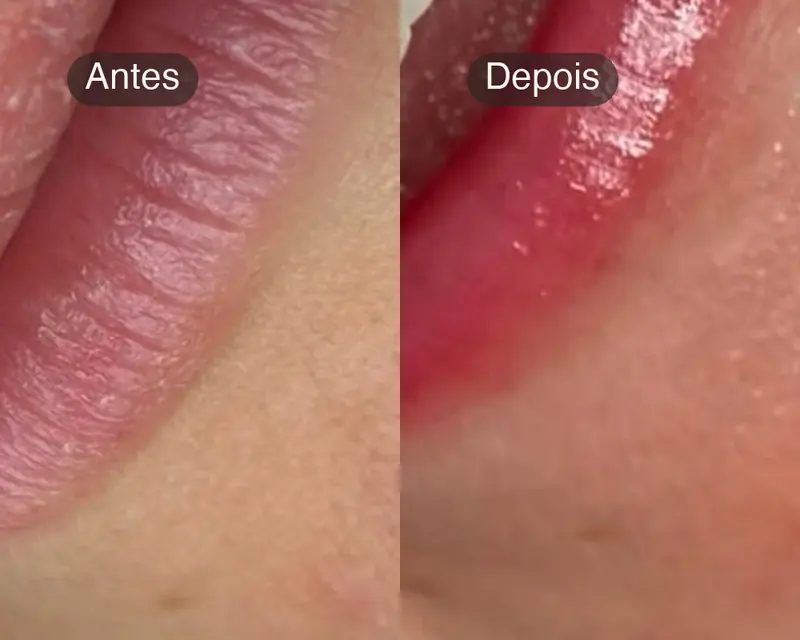 Antes e depois dos lábios com HydraGloss Lips